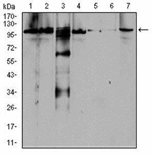 RAB11FIP1 Antibody