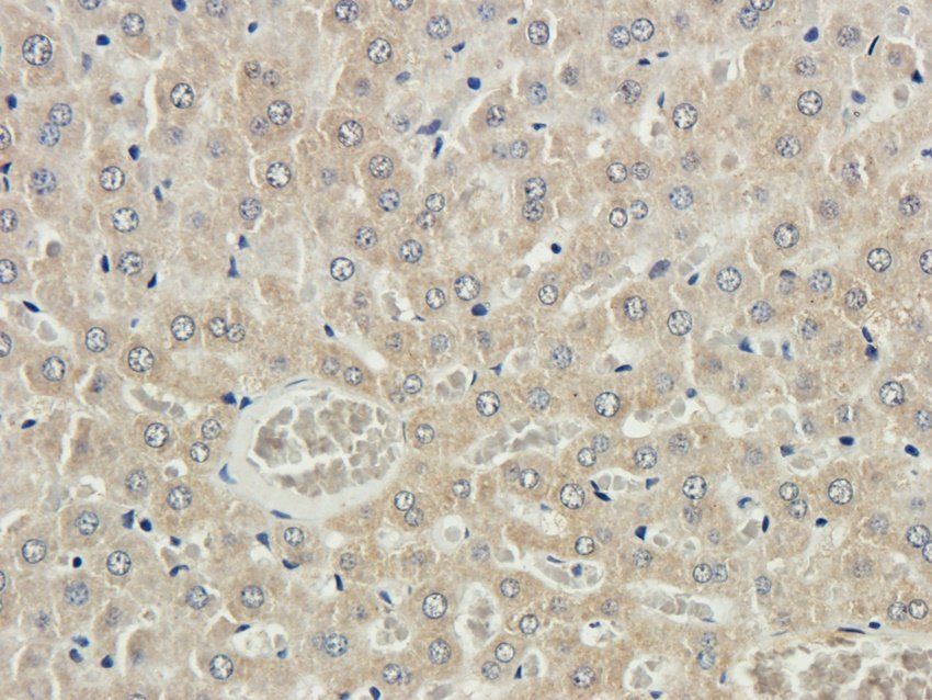 RAB21 antibody