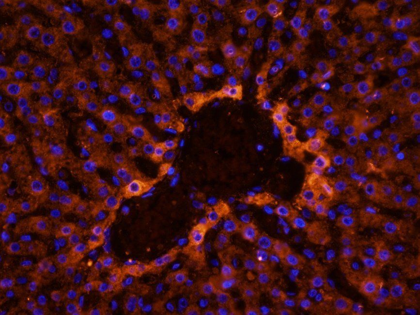 RAB21 antibody