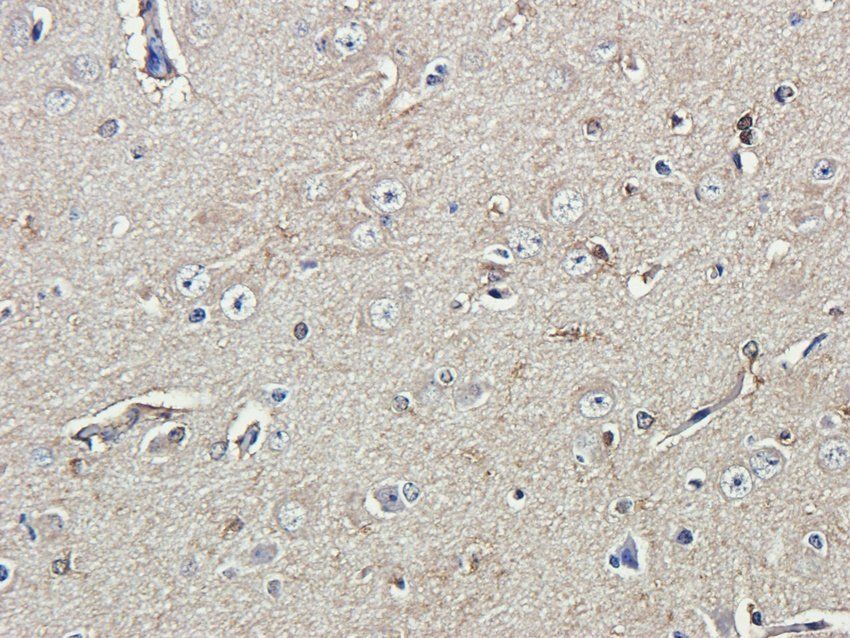 RAB21 antibody