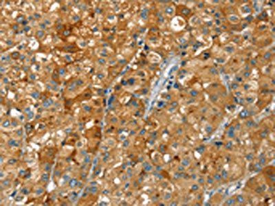 RAB25 Antibody