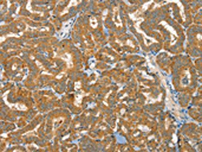 RAB25 Antibody