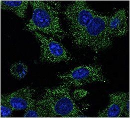 Rab25 Antibody