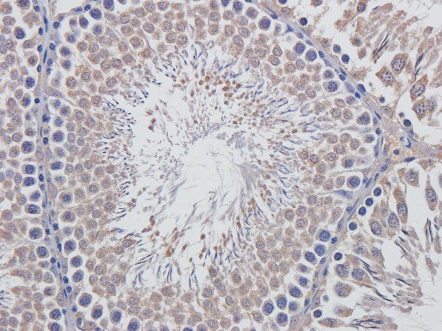 Rab28 antibody