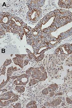 Rab 2 antibody