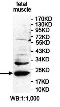 RABAC1 Rabbit Polyclonal Antibody