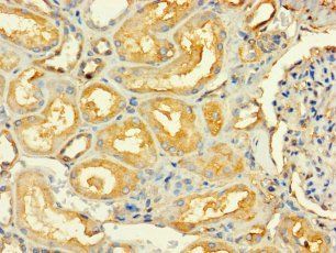RABGGTA Antibody