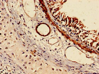 RABGGTA Antibody
