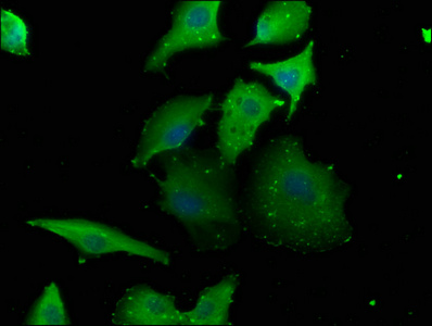 RABGGTB Antibody