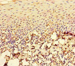 RAC1 Antibody