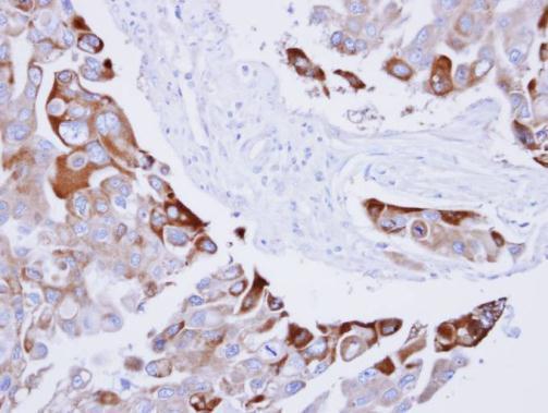 Rac1 Rabbit Polyclonal Antibody