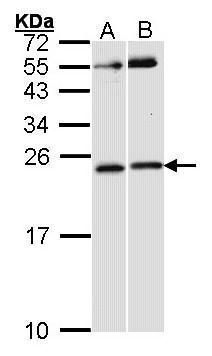 Rac1 Rabbit Polyclonal Antibody