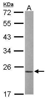 Rac1 Rabbit Polyclonal Antibody