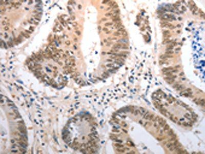 RAD50 Antibody