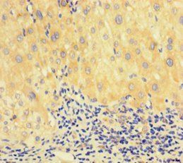 RAD51 Antibody