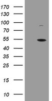 RAD51L1 Antibody