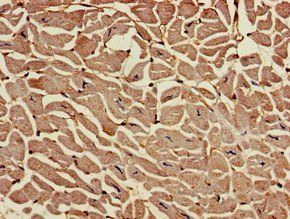RAI1 Antibody