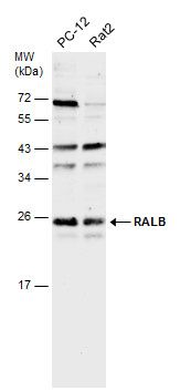 RALB Rabbit Polyclonal Antibody