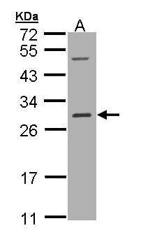 RALB Rabbit Polyclonal Antibody