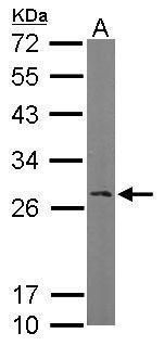RAN binding protein 1 Antibody