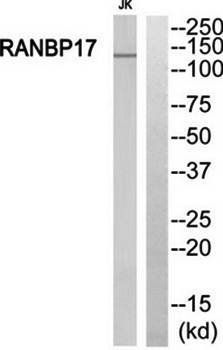 RANBP17 Antibody
