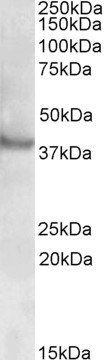 RAPSN/Rapsyn Antibody