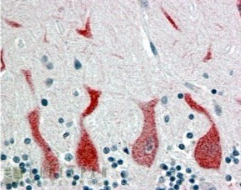 RARA Antibody