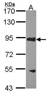 AKAP10 Rabbit Polyclonal Antibody