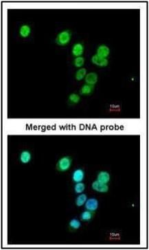 RASAL1 Rabbit Polyclonal Antibody