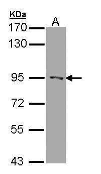 RASAL1 Rabbit Polyclonal Antibody