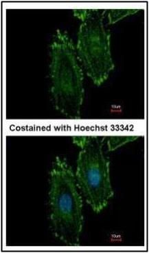 RASGRP4 Rabbit Polyclonal Antibody