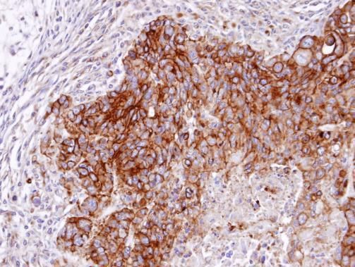 RASGRP4 Rabbit Polyclonal Antibody