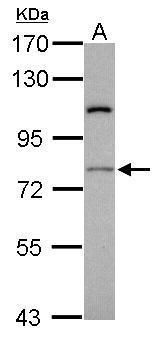 RASGRP4 Rabbit Polyclonal Antibody