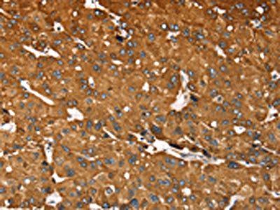 RASSF3 Antibody
