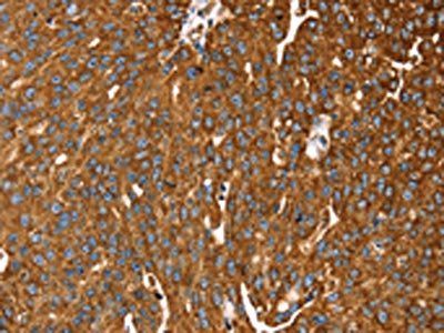 RASSF3 Antibody