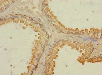 RASSF6 Antibody