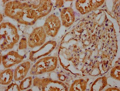 RASSF6 Antibody