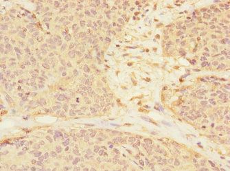 RASSF6 Antibody