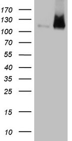 RB1 Antibody