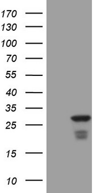 RB1 Antibody