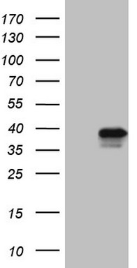 RB1 Antibody
