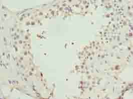 RBBP4 Antibody