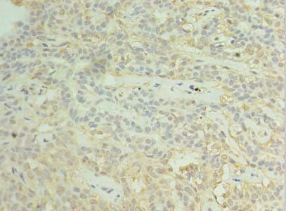 RBM11 Antibody