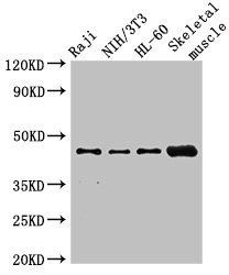 RBM22 Antibody