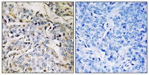 RBM34 Antibody