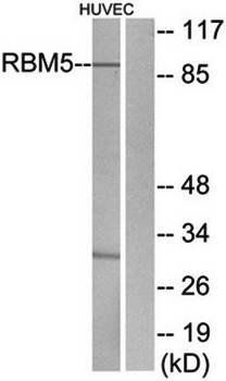 RBM5 Antibody
