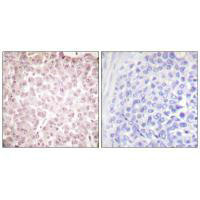 RCC1 Antibody
