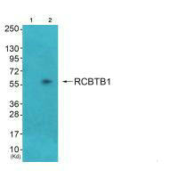 RCC1 Antibody