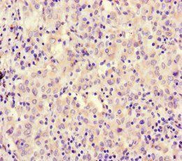 RCOR1 Antibody