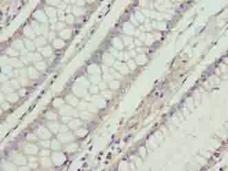 RD3 Antibody
